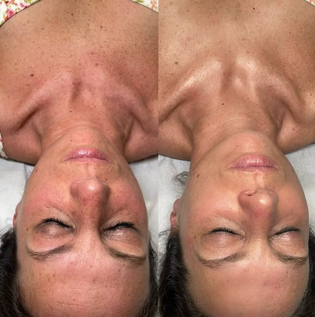 Una donna è sdraiata sulla schiena con gli occhi chiusi.