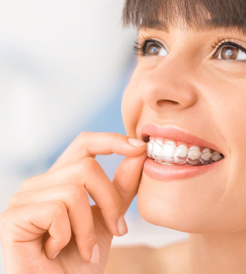 Woman Wearing Orthodontic Silicone Trainer — Edina, MN — Interlachen Dental Associate