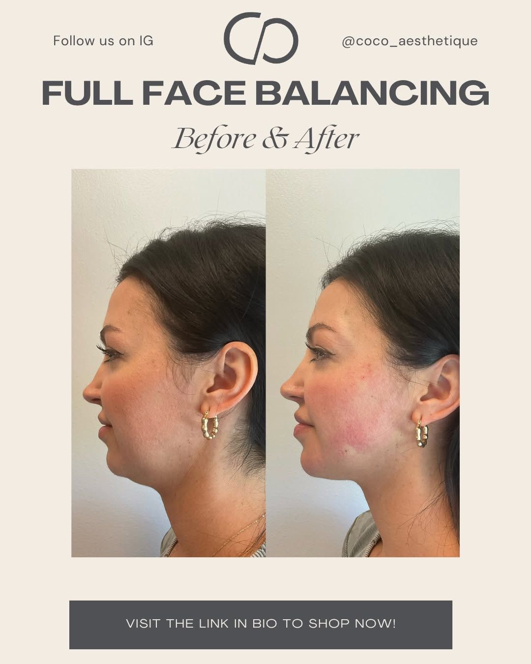 Side-by-side comparison of a woman's face showing