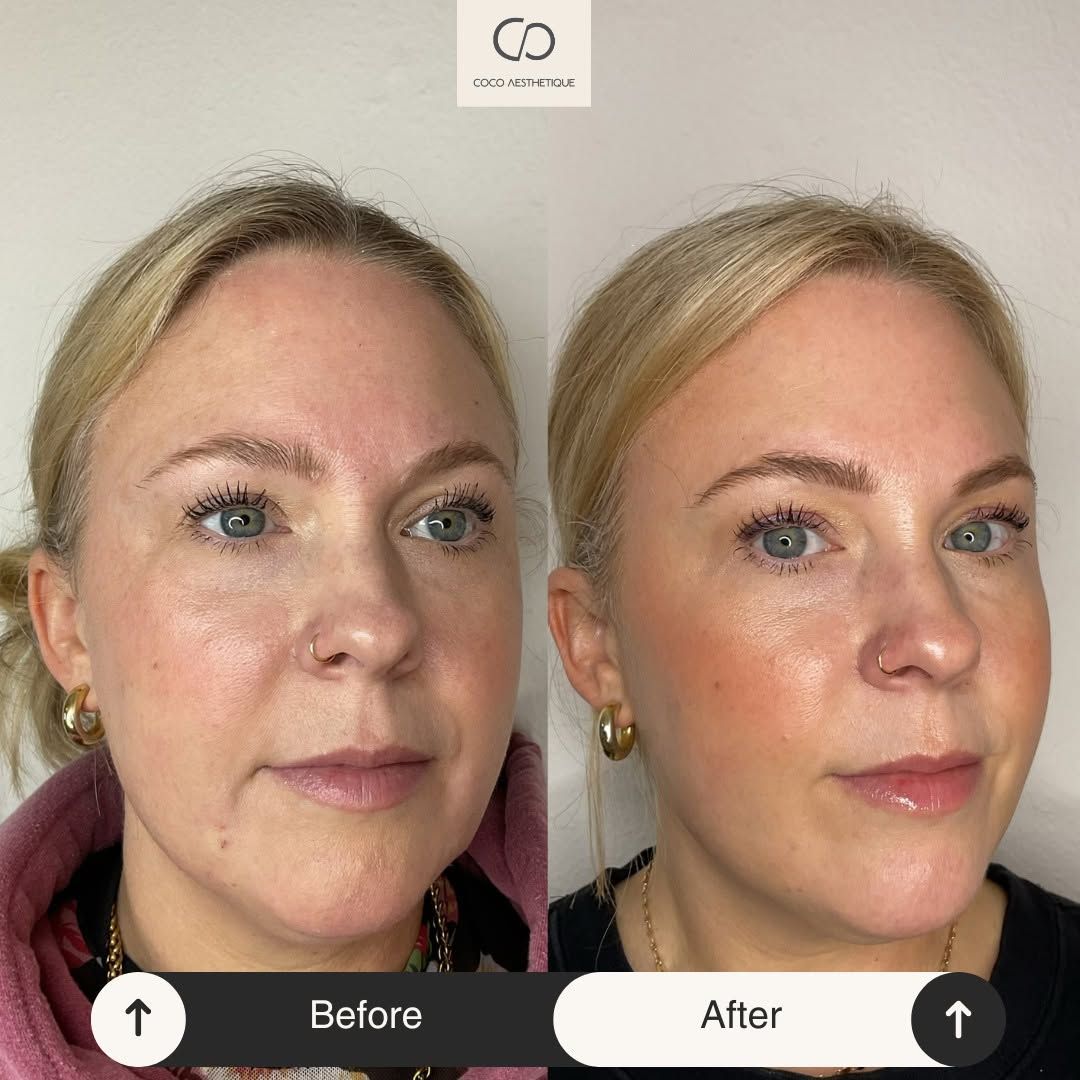 Before and after photos of a woman's face. The