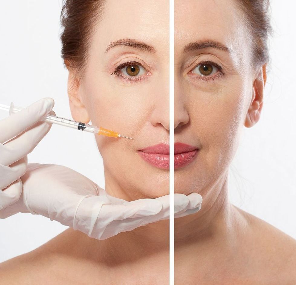 A woman's face split, showing one half with wrinkles and the other half receiving a cosmetic injection.