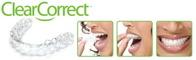 Clear Correct — Yorktown, VA — Scott J. Golrich, DMD