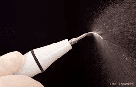 Teeth Cleaner Tool — Yorktown, VA — Scott J. Golrich, DMD