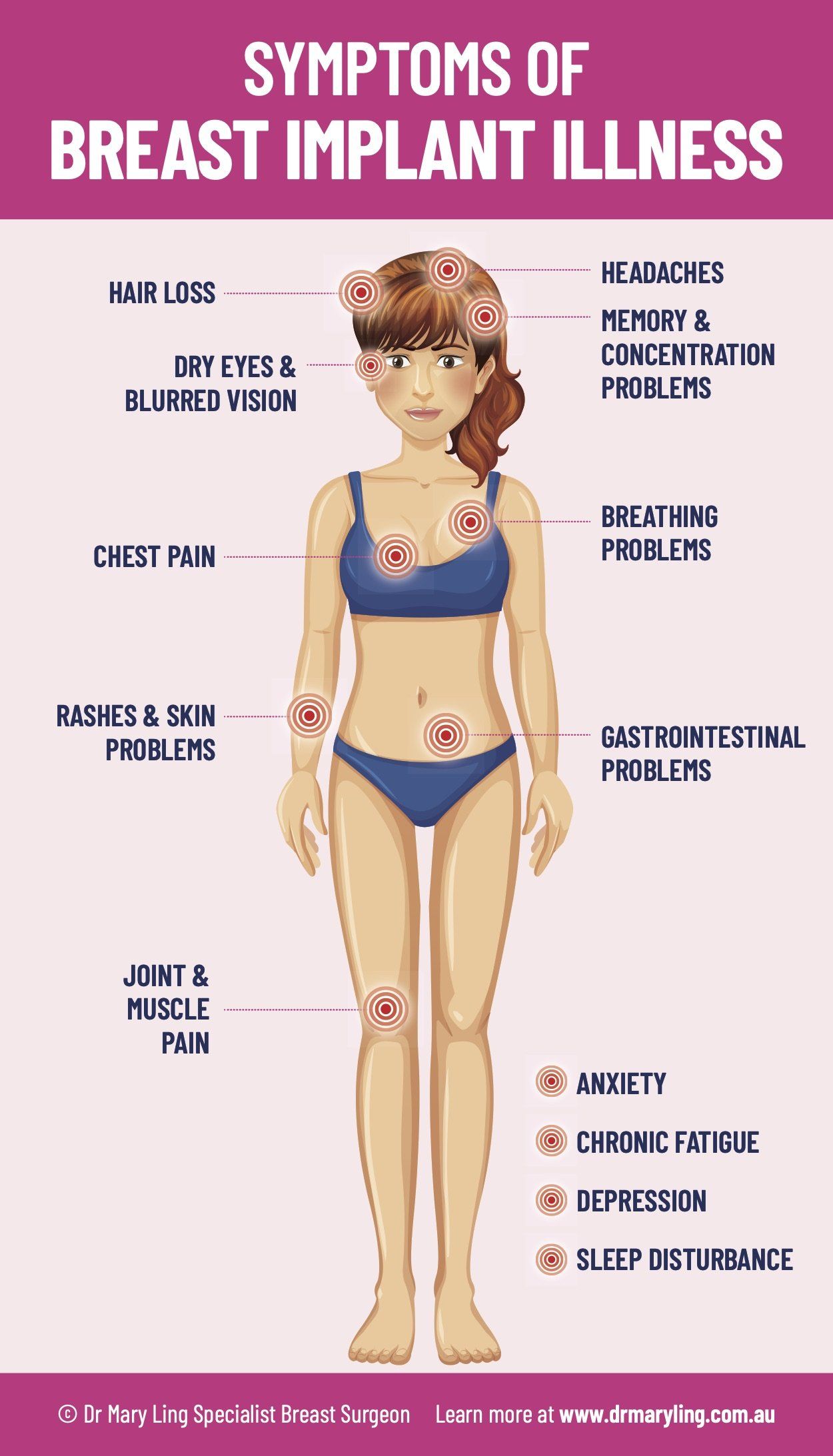 Symptoms of Breast Implant Illness