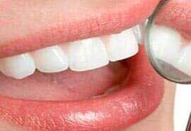 DR. GERARDO T. ROCHA HERRERA - dentista