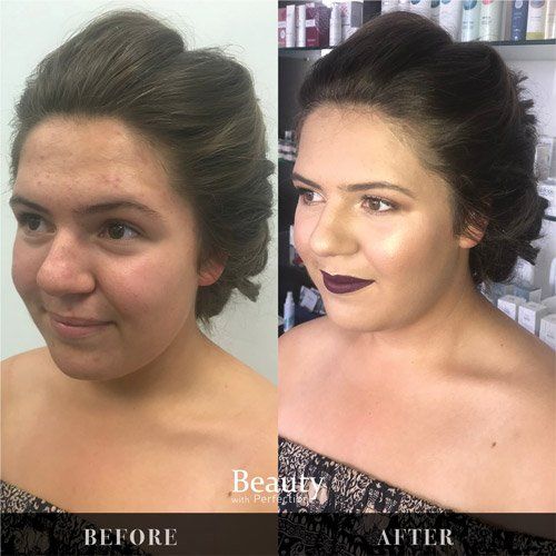 A before and after photo of a woman 's face.