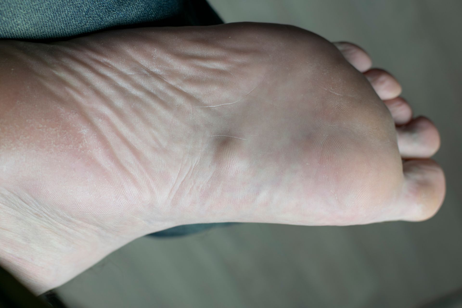 Sole of a foot, light skin tone, visible wrinkles and lines.