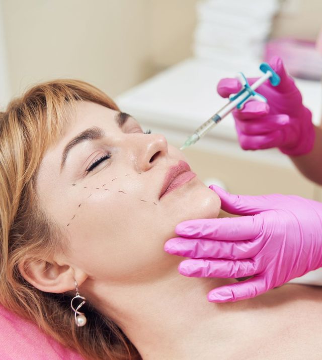 San Antonio Dermal Filler Experts - Latest Filler Treatments