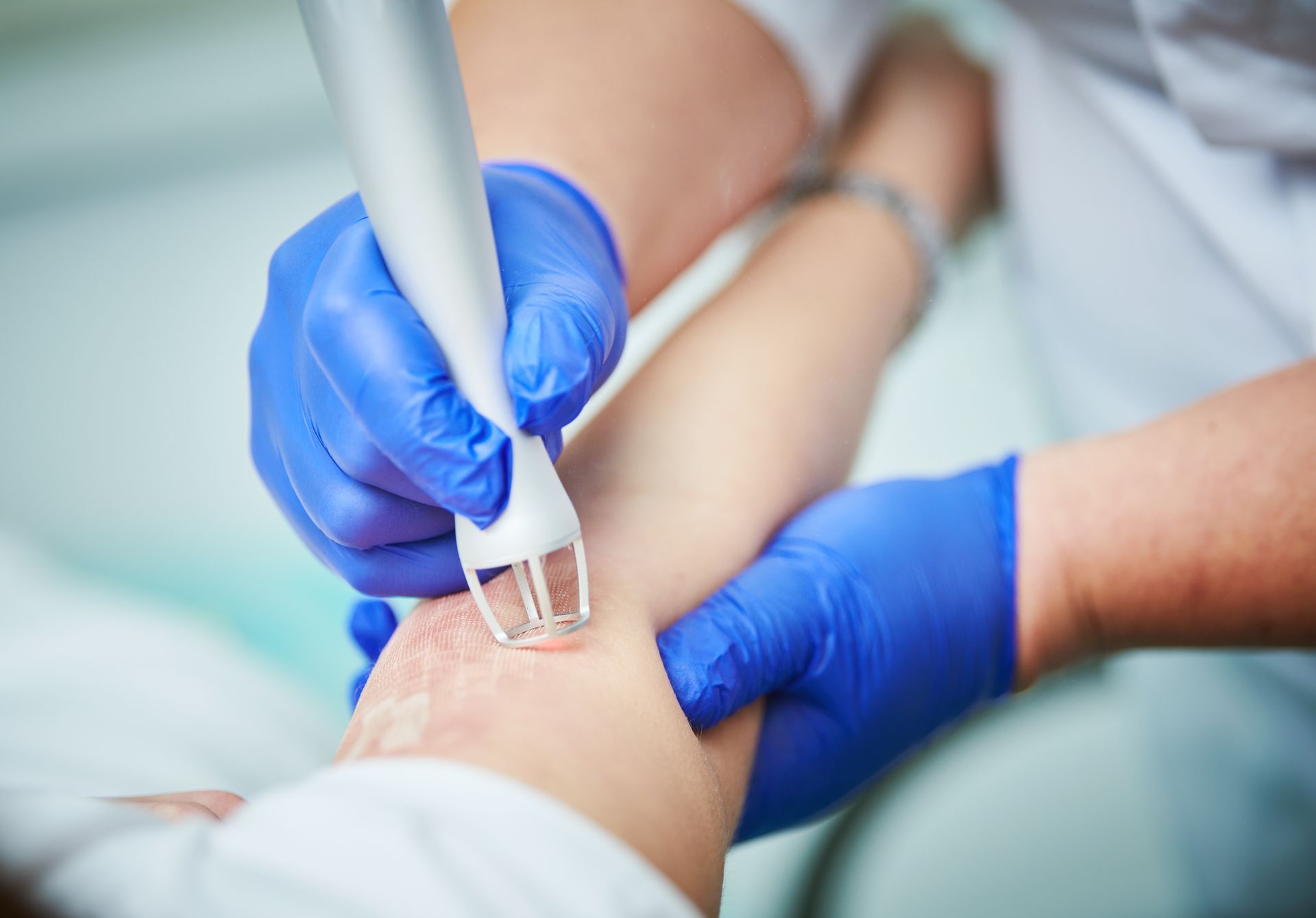 A person is getting a laser treatment on their wrist.