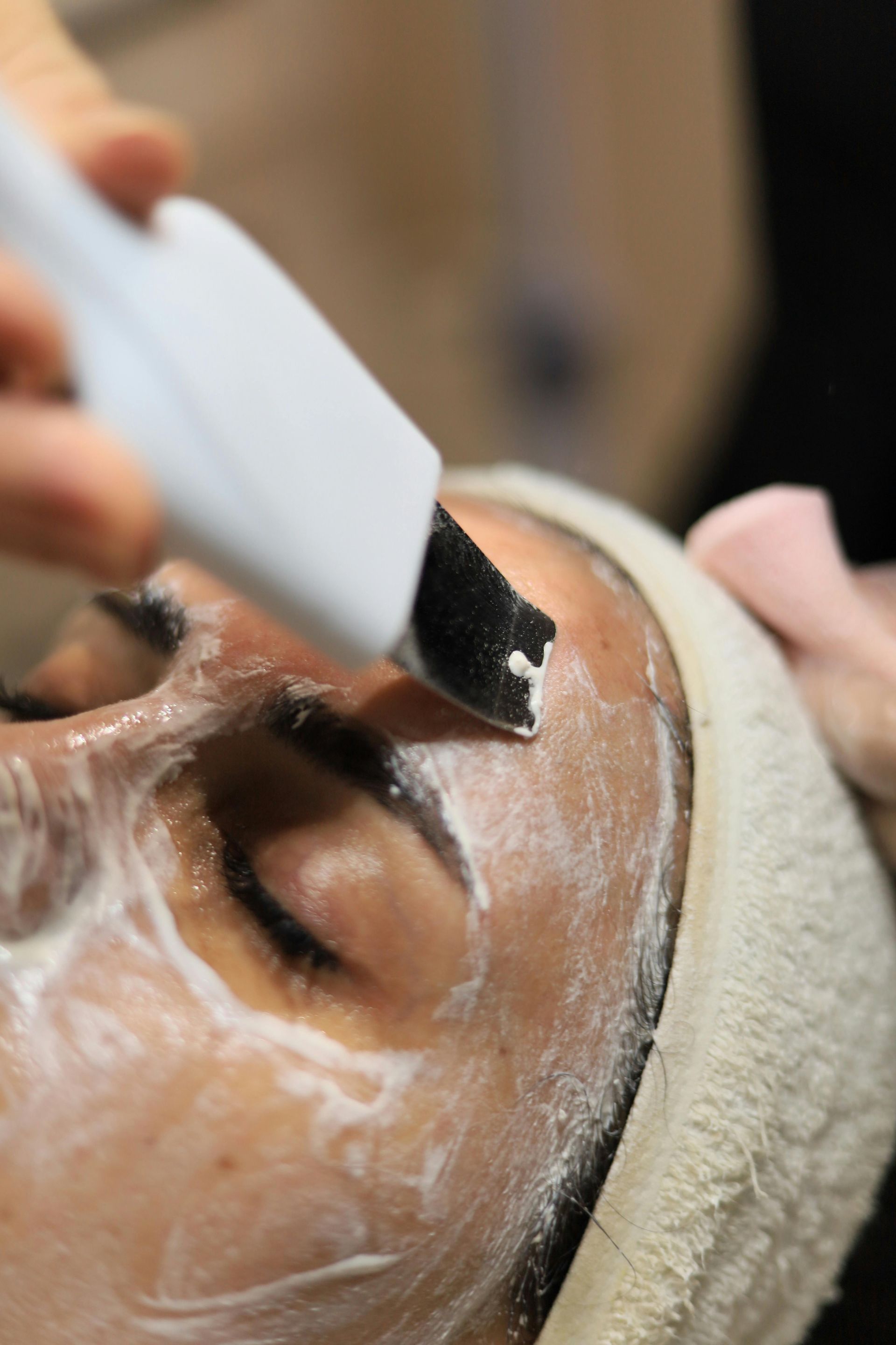 Woman Receiving Microdermabrasion Treatment On Her Forehead — Penelope's Beauty in Raymond Terrace, NSW