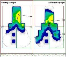 Gebiomized Saddle Pressure mapping