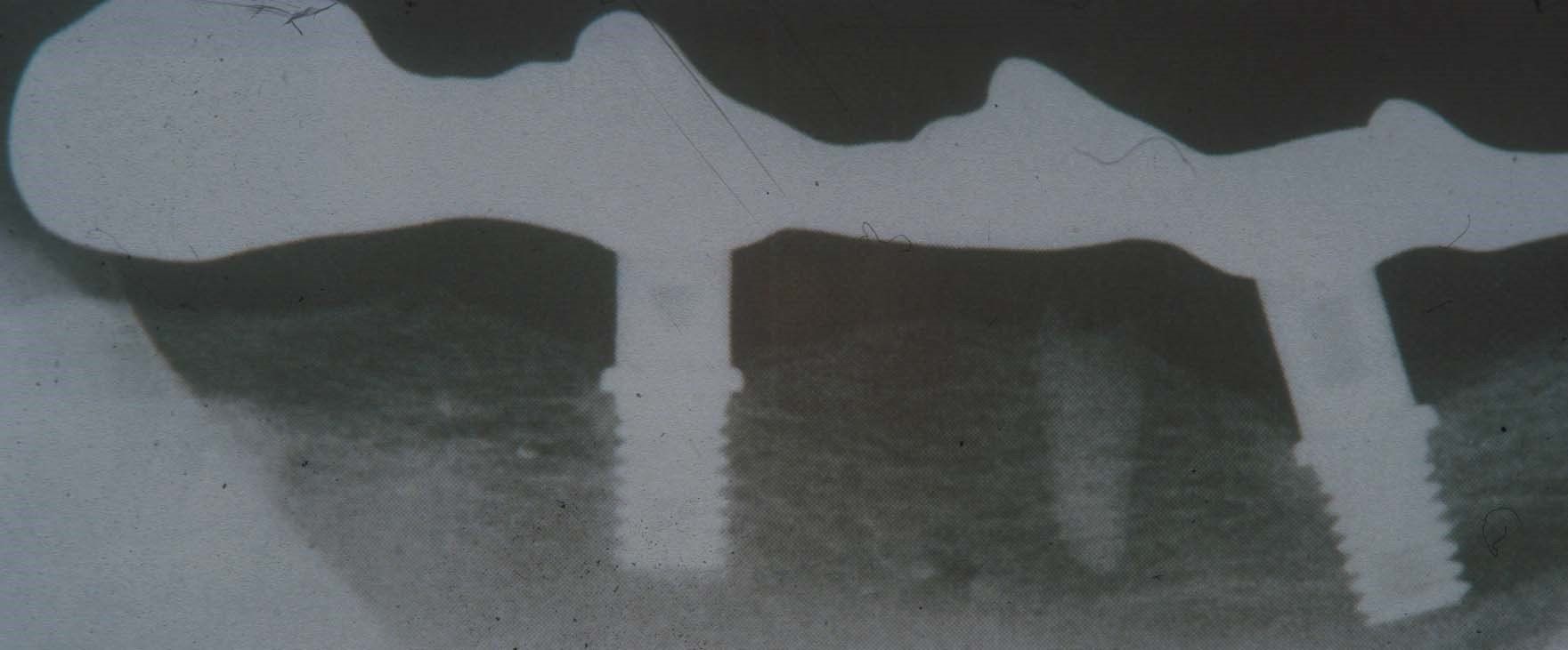 Radiografia del ponte protesico nell'animale