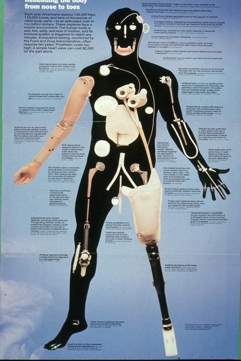 Moltepici applicazioni del titanio in sedi extraorali