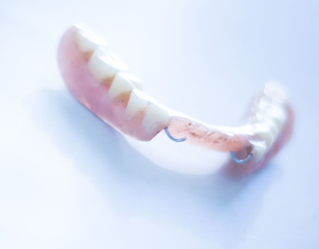 osteointegrazione degli elementi dentali