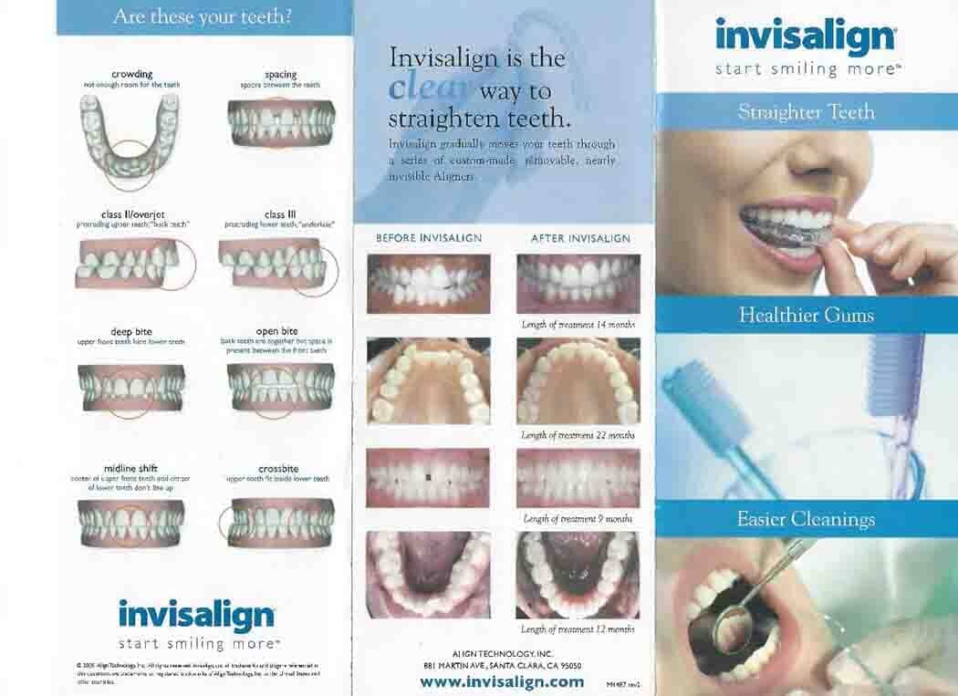 Invisalign info - Dental Services in Mansfield, OH