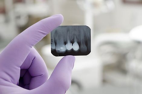 Gum Infection — Teeth X-Ray in Mansfield, OH