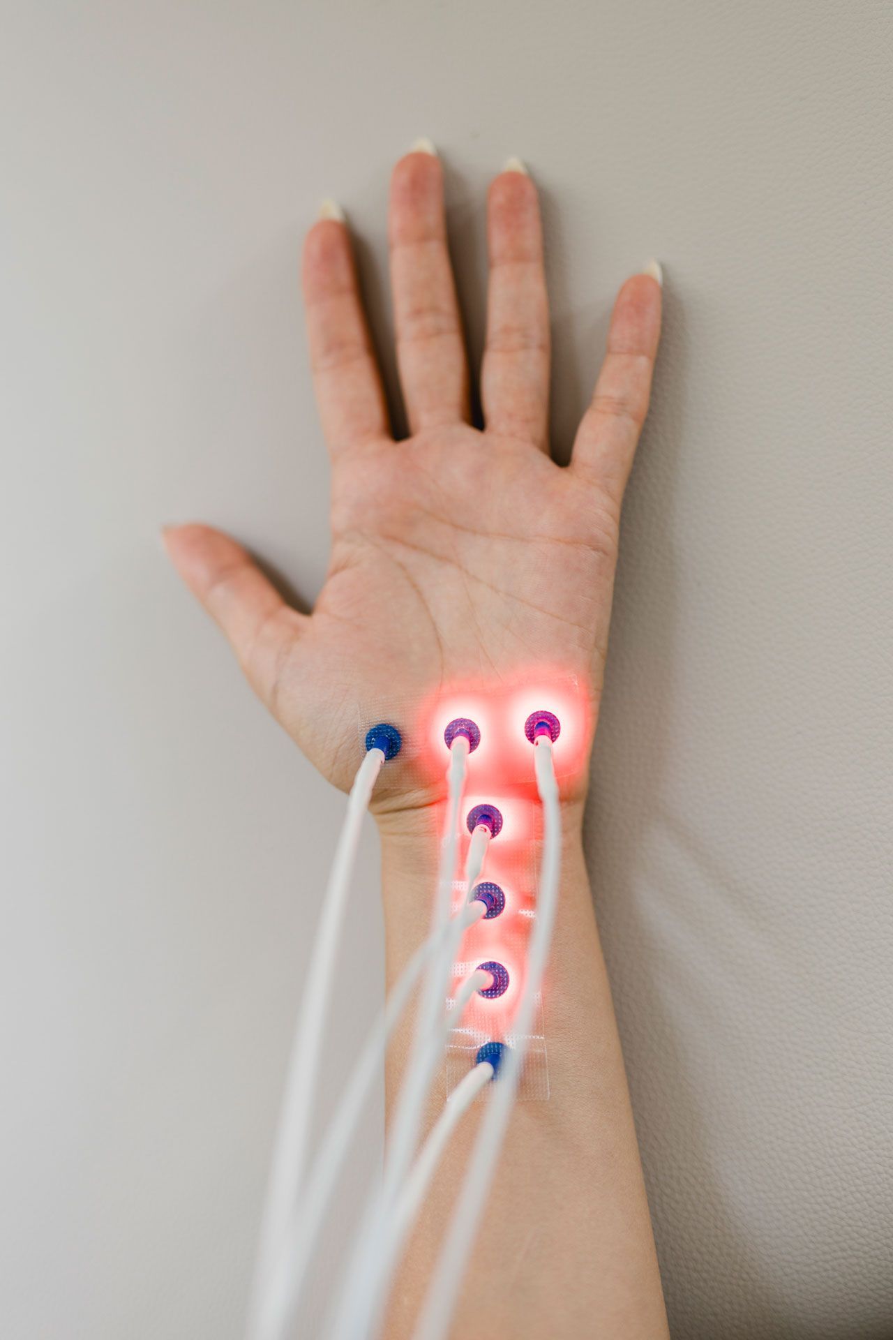 Laserneedle-Therapie, Laser sind an eine Hand angeschlossen, sie leuchten