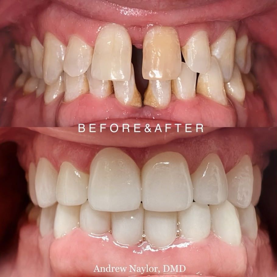 Before & After - Andrew Naylor, DMD