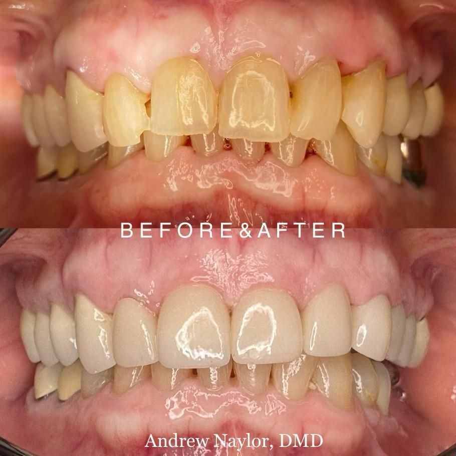 Before & After - Andrew Naylor, DMD