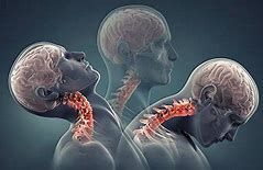 A computer generated image of a man 's neck and brain.