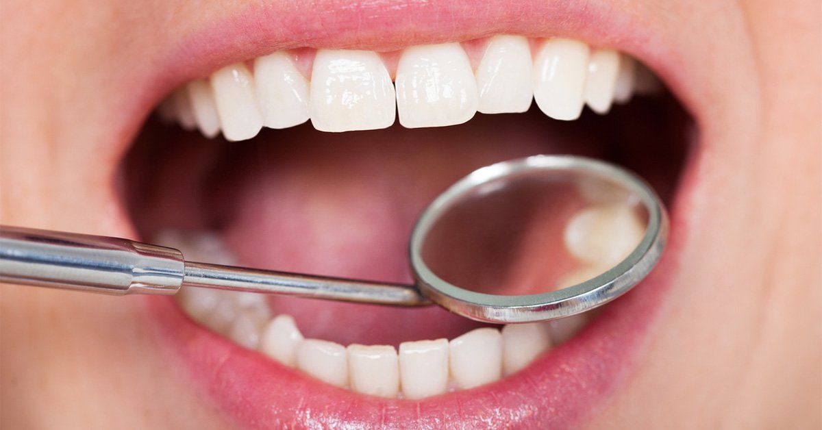 tooth filling riverside dental