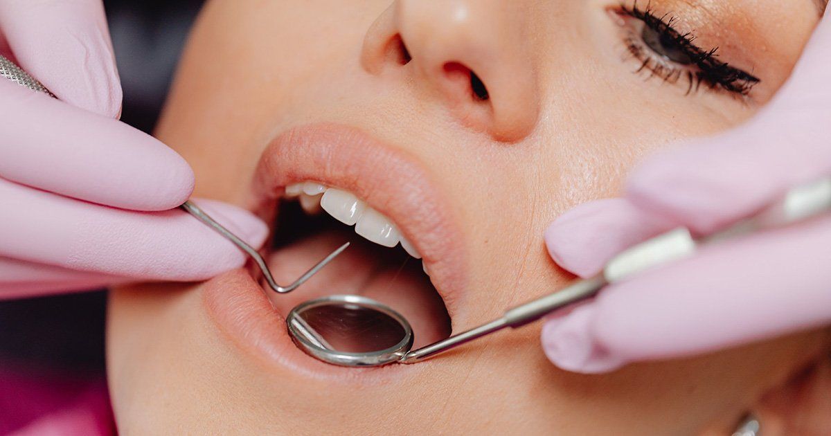 dental cleaning, dentist in New York NY