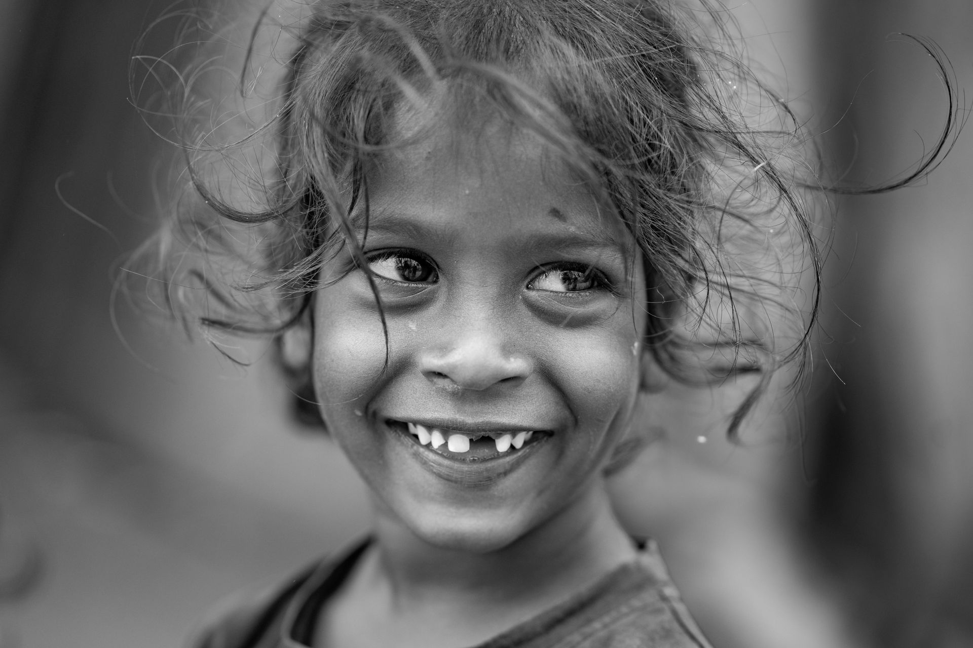 girl with missing tooth