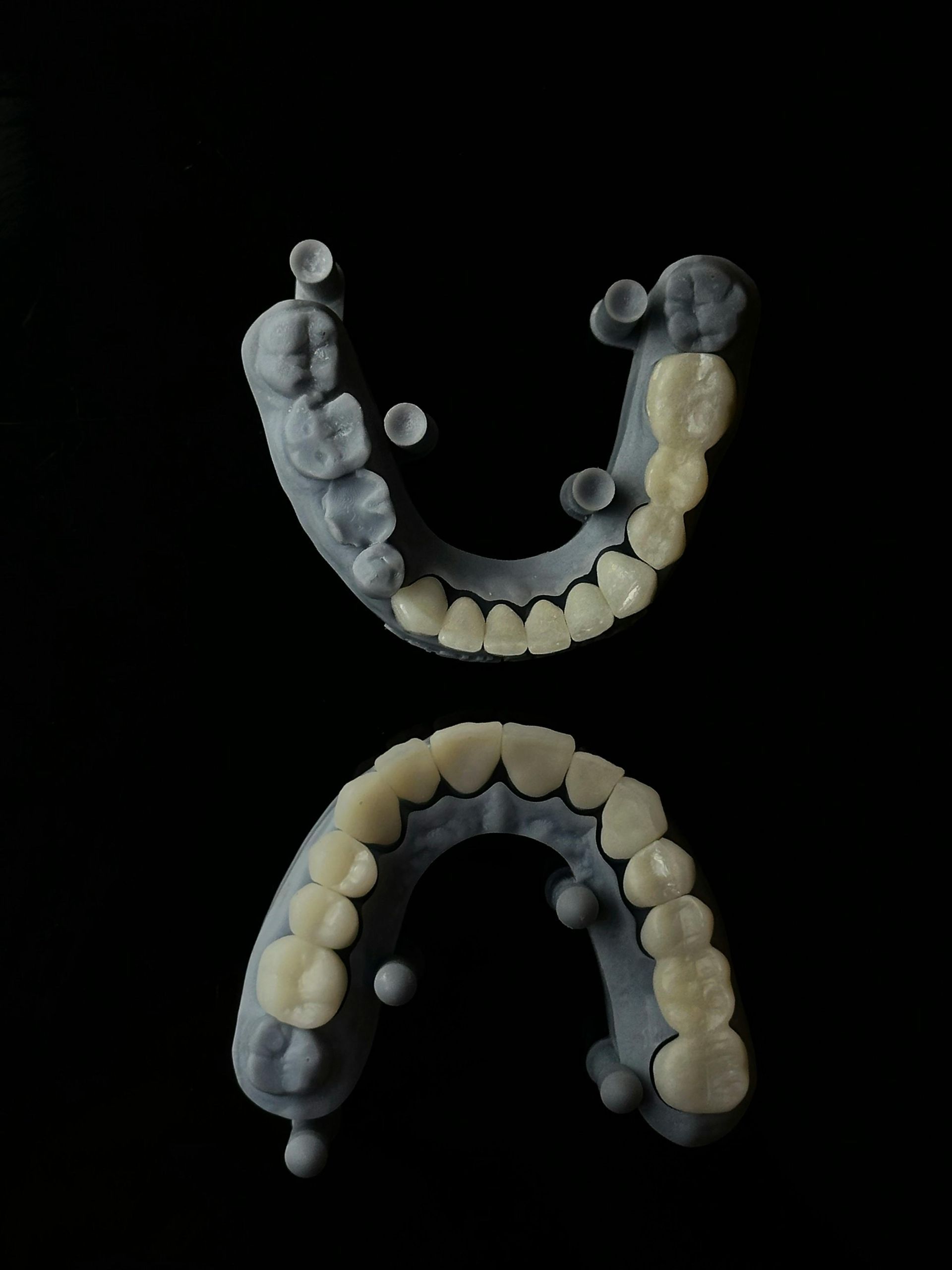 Model for dental implants