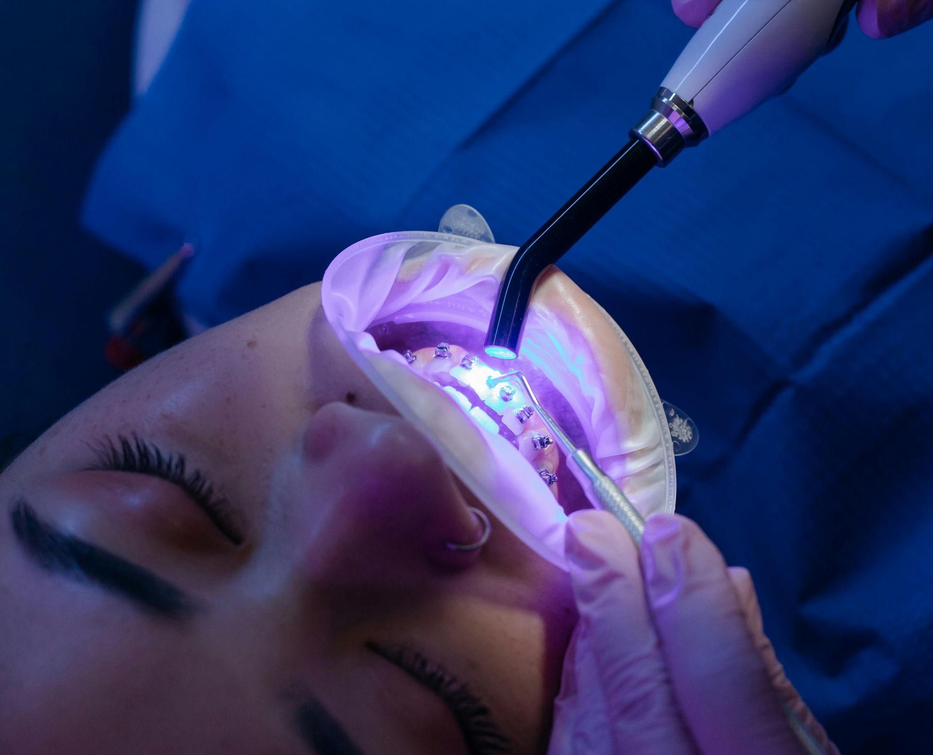 person getting laser