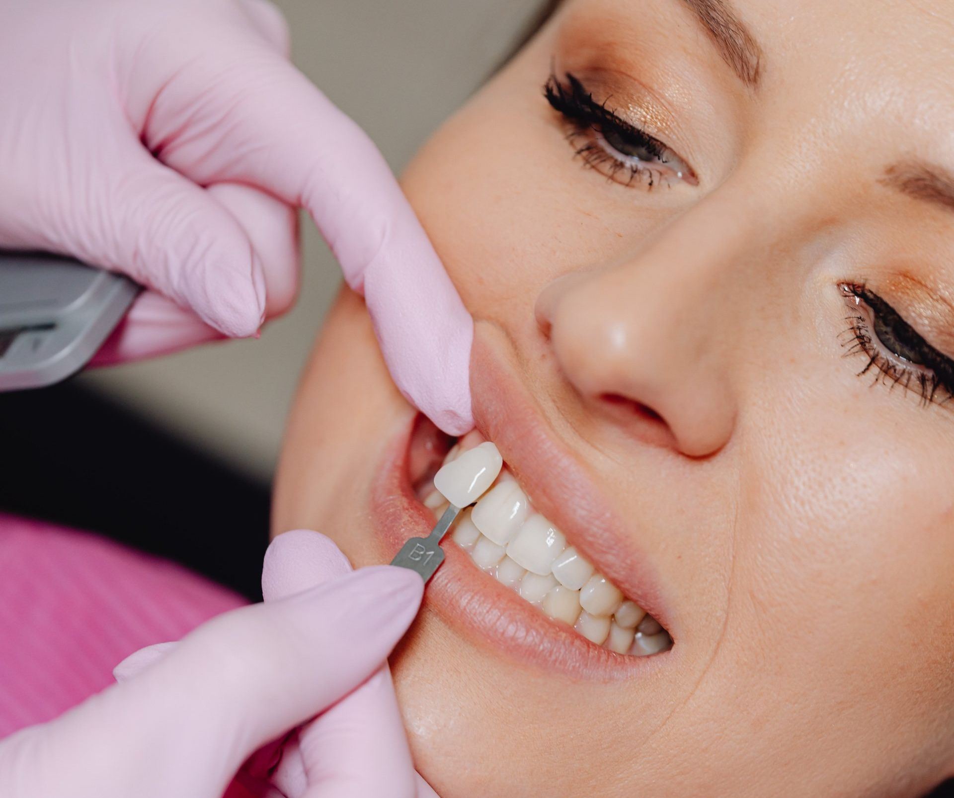 Woman matching a porcelain veneer to her natural teeth color.