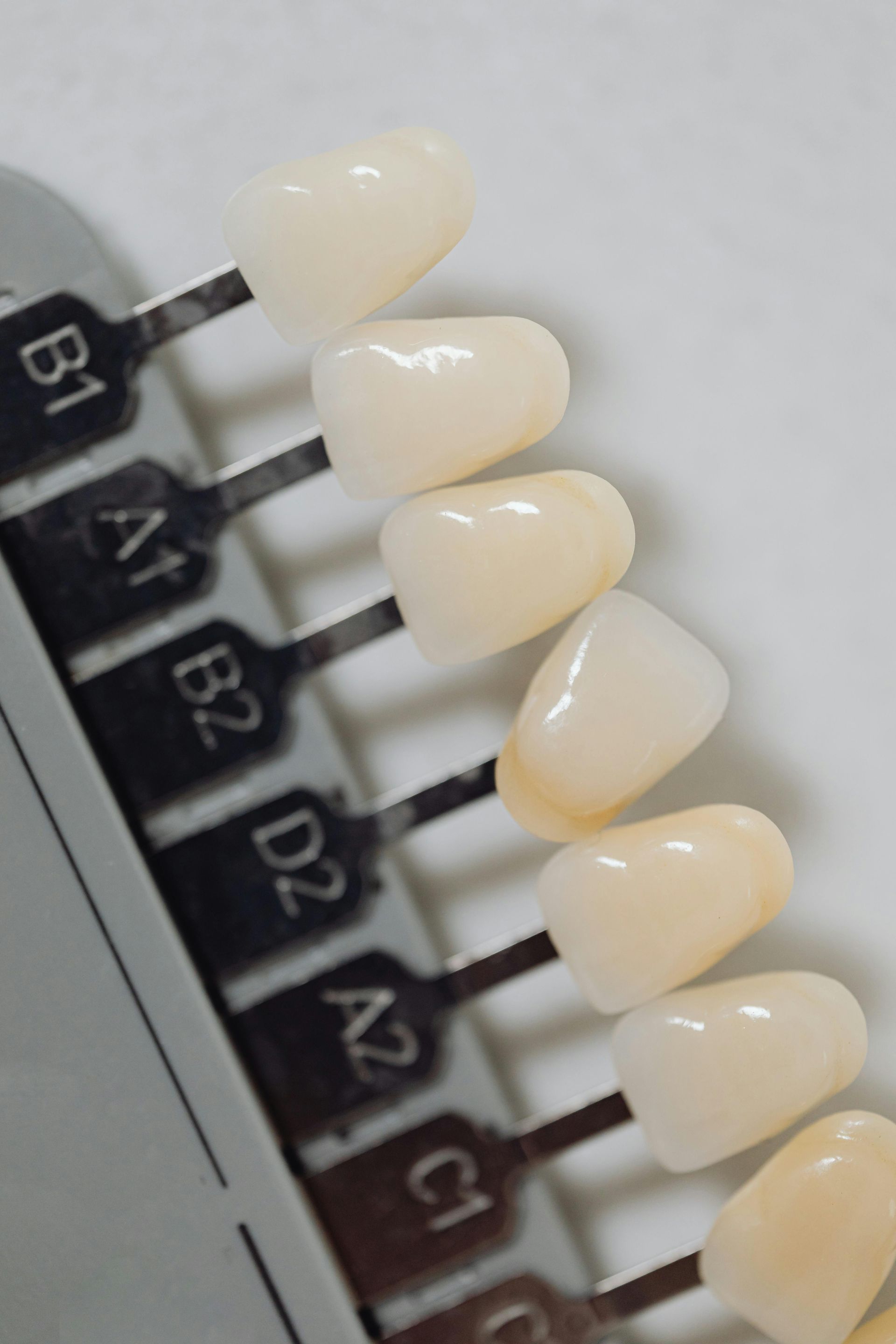 Veneers in different shades 