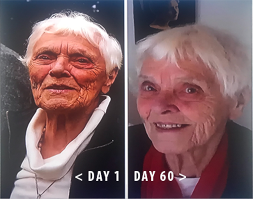 Left Day 1. Right Day 60.