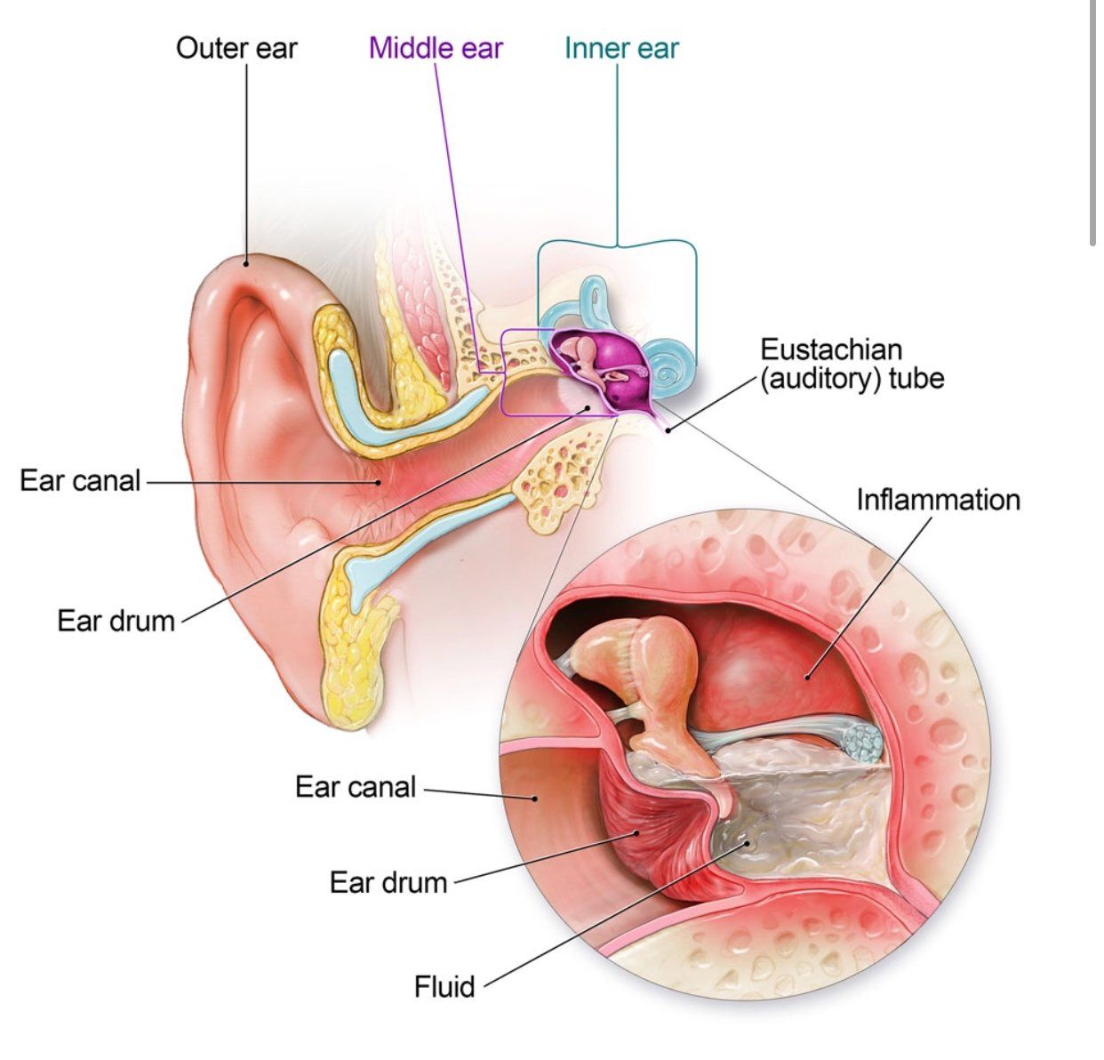 Urgent care for Ear Infection
