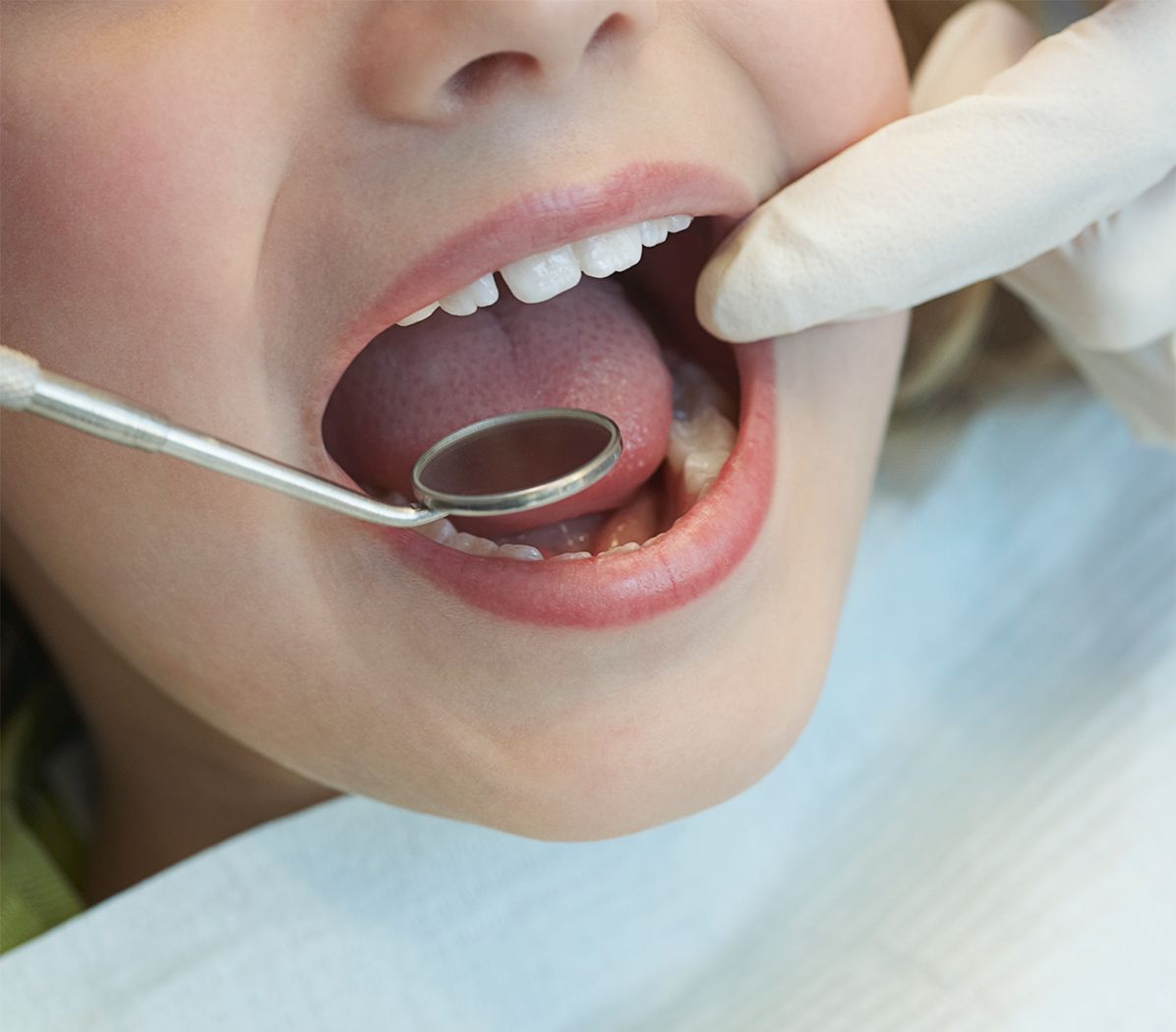 CLÍNICA SAN JOSÉ ESPECIALIDADES DENTALES - Cirugía Maxilofacial