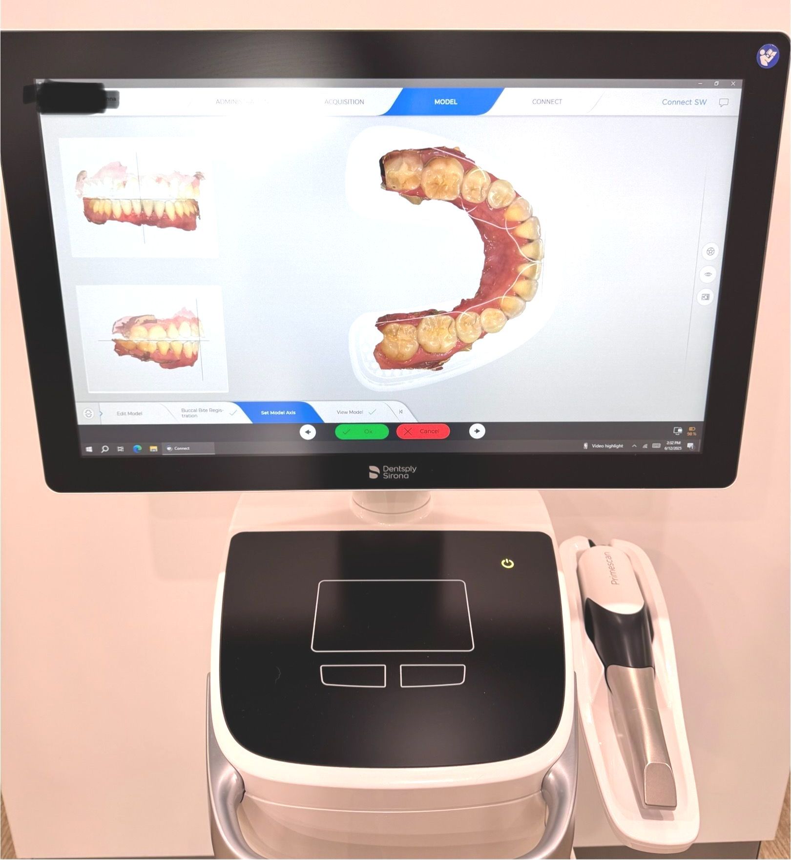 This digital 3D impression scanning method is quicker, more precise, and enhances comfort for patients.