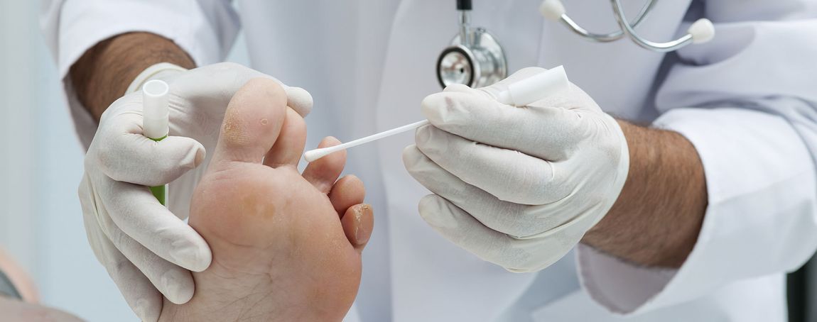 podiatrist swabbing foot with q-tip