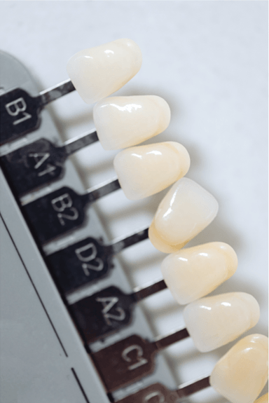 Branqueamento dentário, dentes brancos, sorriso