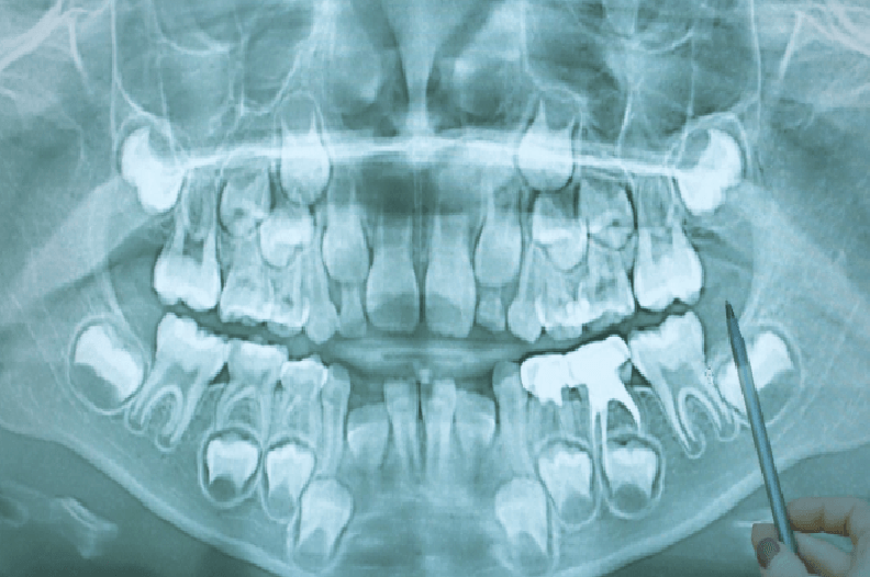 Extração dentária, Implantologia, Implantes Dentários, Tratamento lesões orais