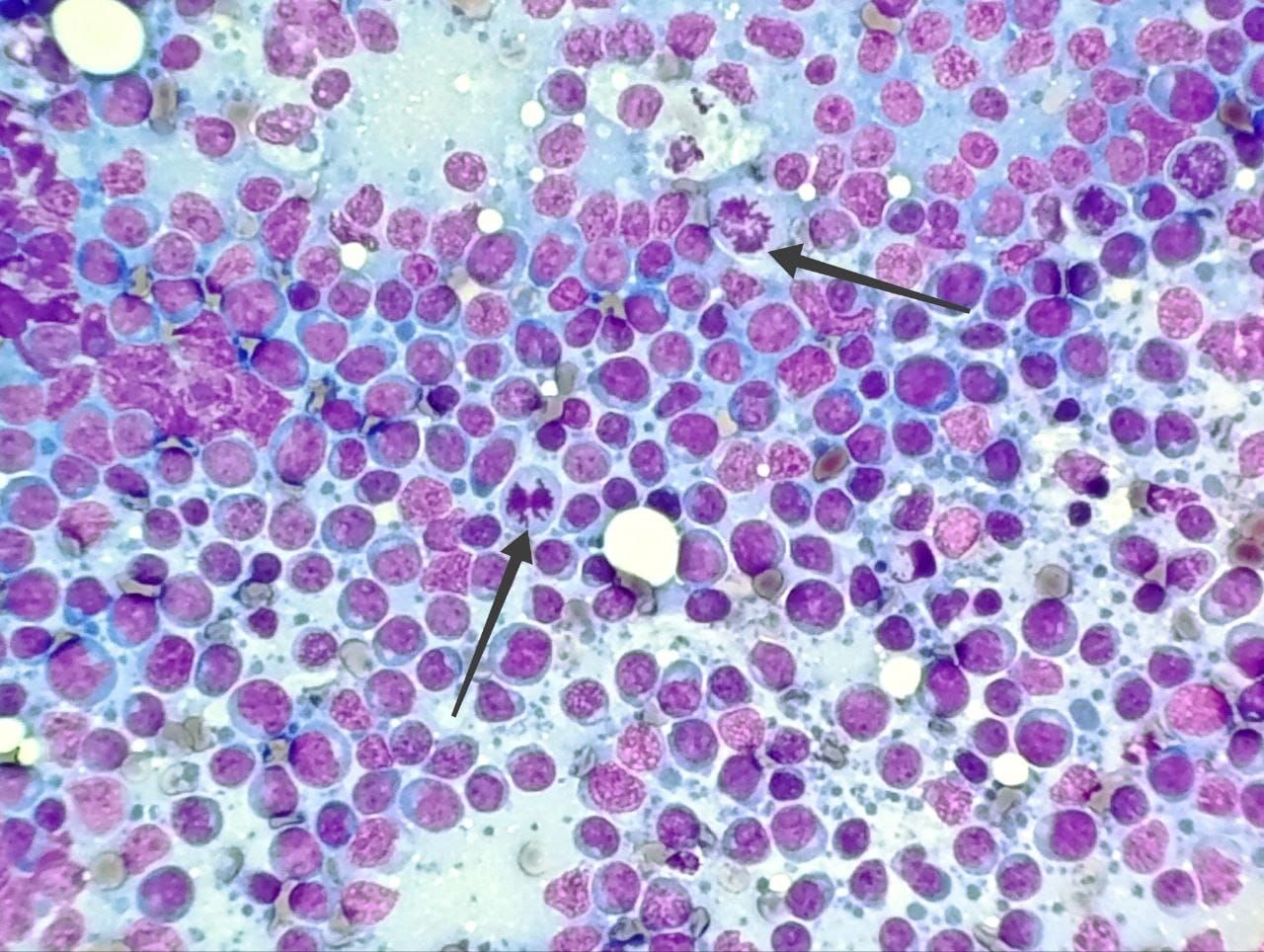 Mano enguantada sosteniendo un portaobjetos de microscopio con tejido teñido, sobre un fondo de tejido rosa ampliado.