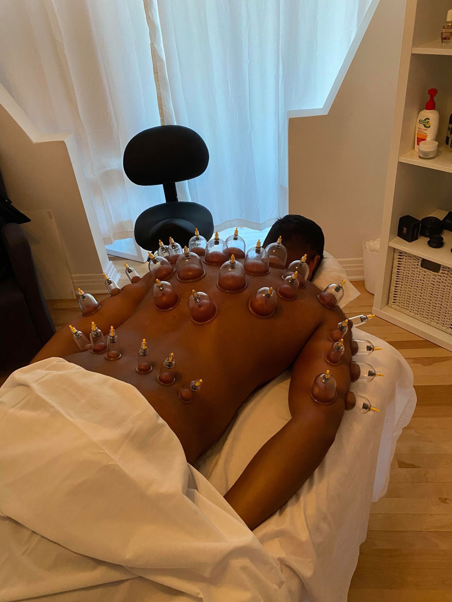 Personne recevant une thérapie par ventouses, allongée face contre terre sur une table de massage avec des ventouses sur le dos.