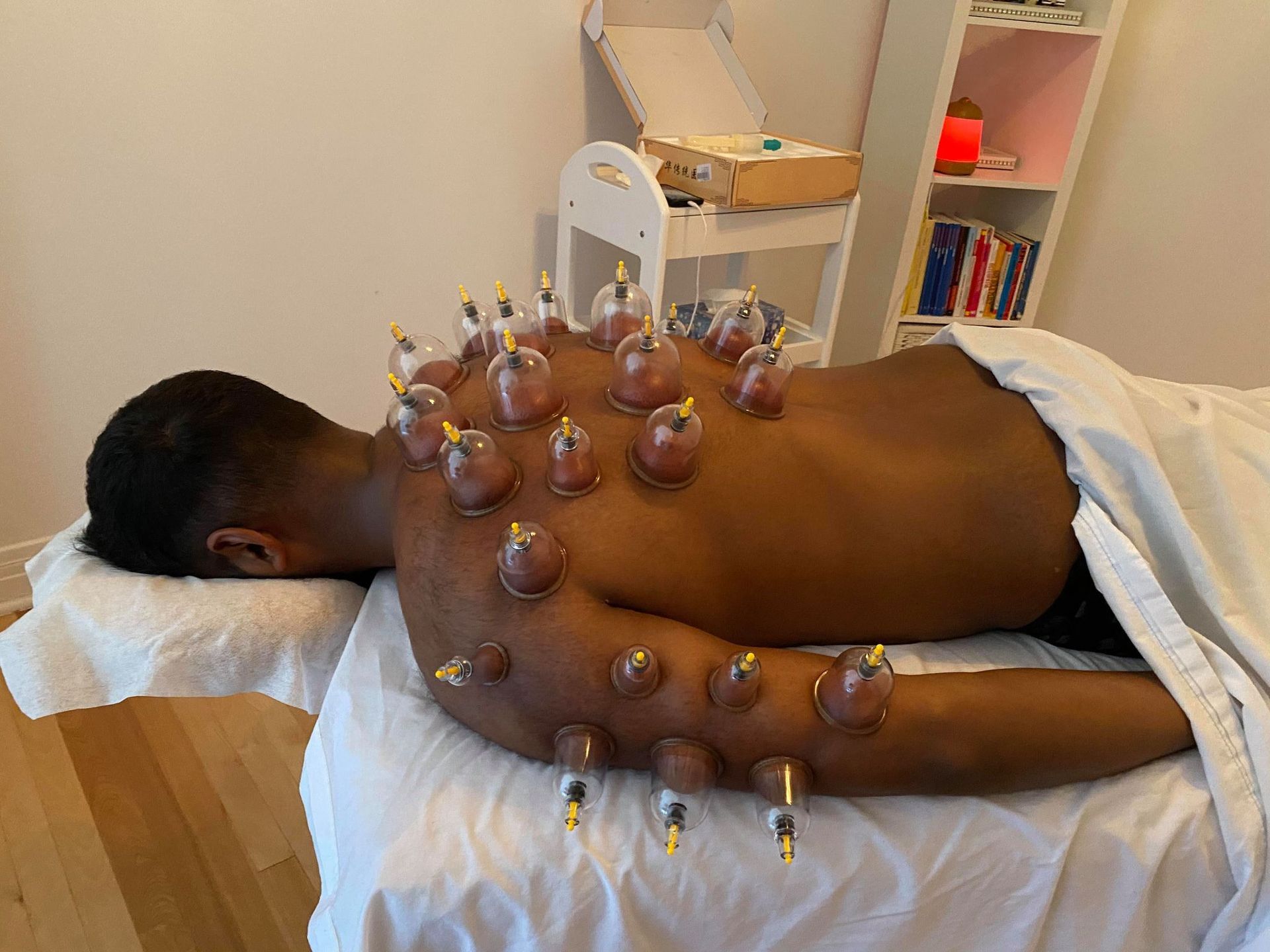 Personne allongée sur le ventre, recevant une thérapie par ventouses. Ventouses transparentes placées sur le dos et le bras. Pièce claire.