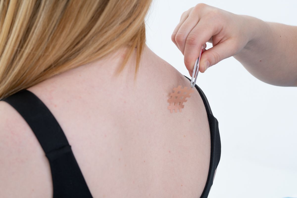 L'épaule d'une personne présentant une lésion cutanée brune est examinée avec une pince à épiler.