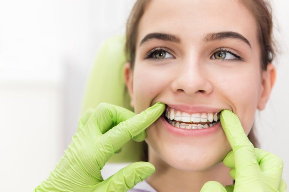 dentista sistema apparecchio a giovane donna
