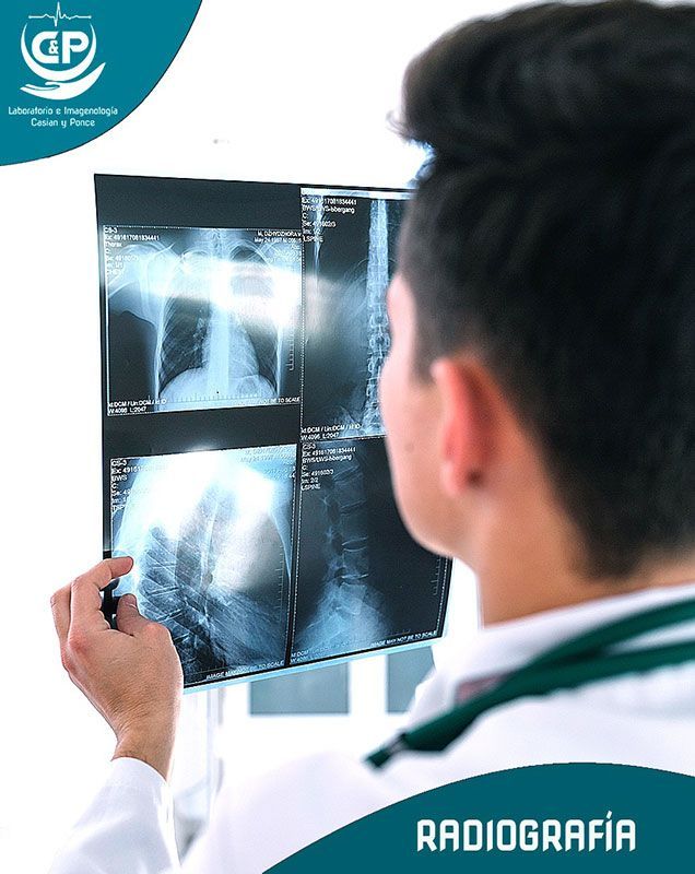 LABORATORIO E IMAGENOLOGÍA CASIAN Y PONCE