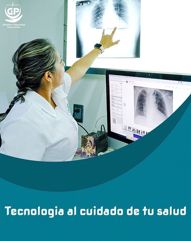 LABORATORIO E IMAGENOLOGÍA CASIAN Y PONCE