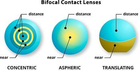 example of power arrangement in bifocal contact lens