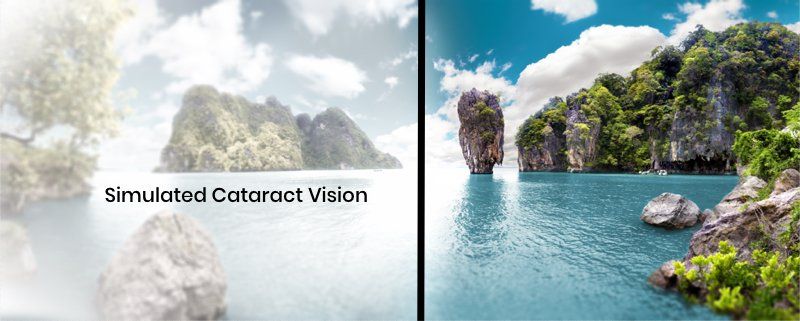 tropical scene with simulated cataract vision