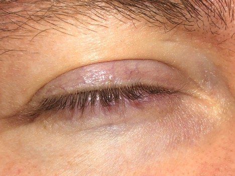 A close up of a person 's closed eye