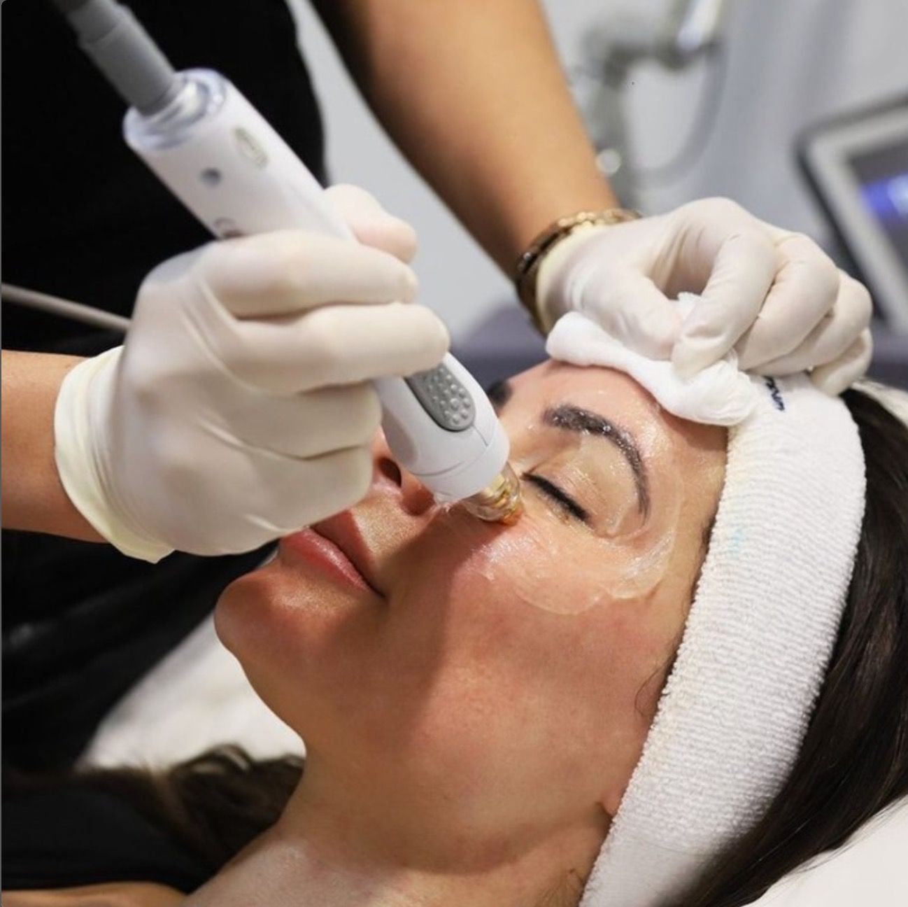 Woman receiving Cynosure resurfacing treatment