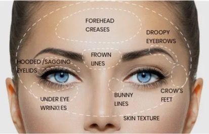 A diagram of a woman 's face showing the different areas of her face.